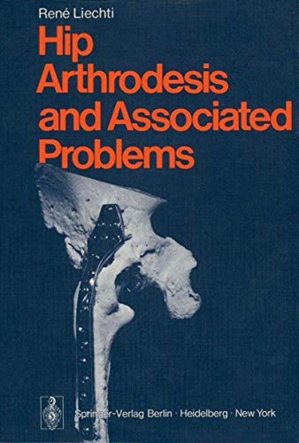 Hip Arthrodesis And Associated Problems-..