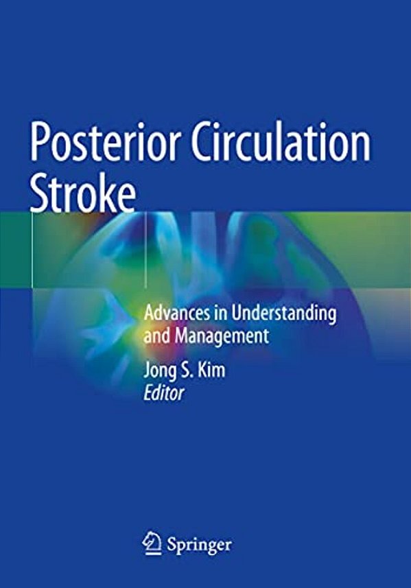 Posterior Circulation Stroke: Advances In Understanding And Management-..
