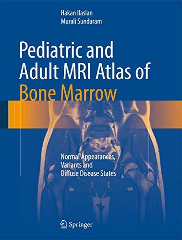 Pediatric And Adult Mri Atlas Of Bone Marrow: Normal Appearances, Variants And Diffuse Disease States-..