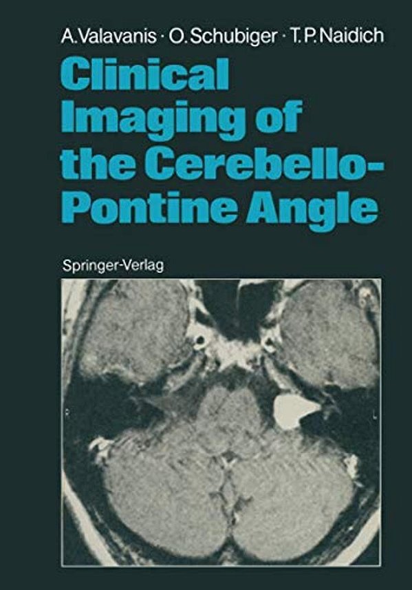 Clinical Imaging Of The Cerebello-Pontine Angle-..