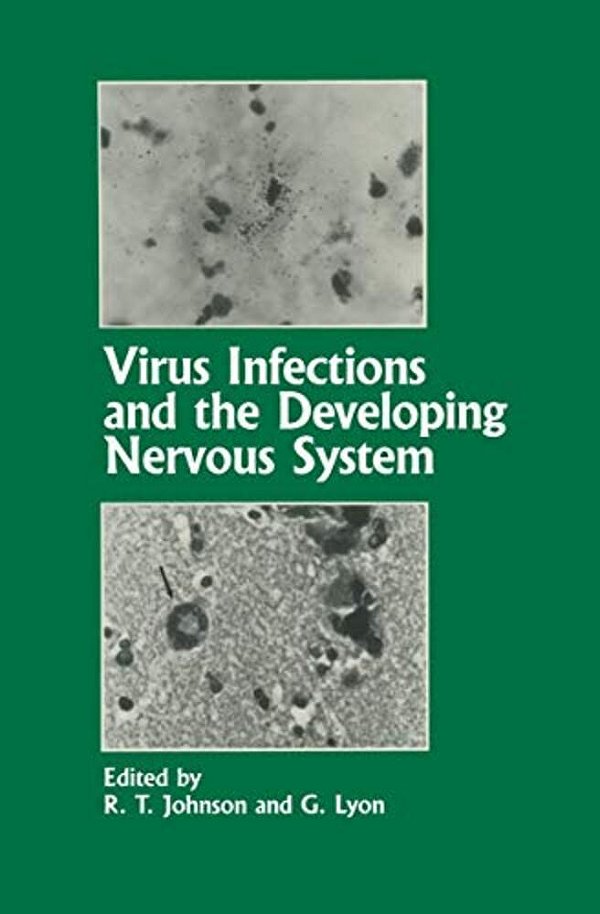 Virus Infections And The Developing Nervous System-..