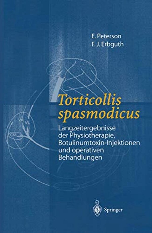 Torticollis Spasmodicus: Langzeitergebnisse Der Physiotherapie, Botulinumtoxin-Injektionen Und Operativen Behandlungen-..