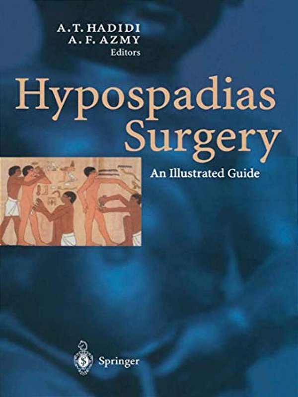 Hypospadias Surgery: An Illustrated Guide-..