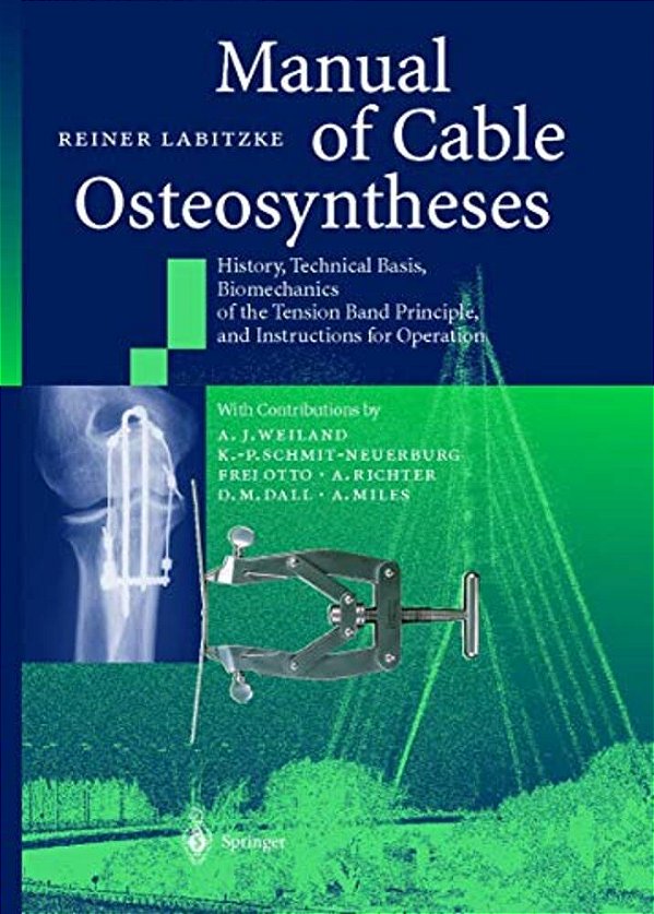 Manual Of Cable Osteosyntheses: History, Technical Basis, Biomechanics Of The Tension Band Principle, And Instructions For Operation-..
