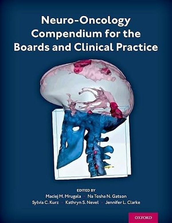 Neuro-Oncology Compendium For The Boards And Clinical Practice-..