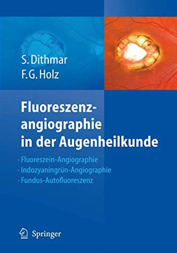 Fluoreszenzangiographie In Der Augenheilkunde: Fluoreszein-Angiographie, Indozyaningrün-Angiographie Und Fundus-Autofluoreszenz-..