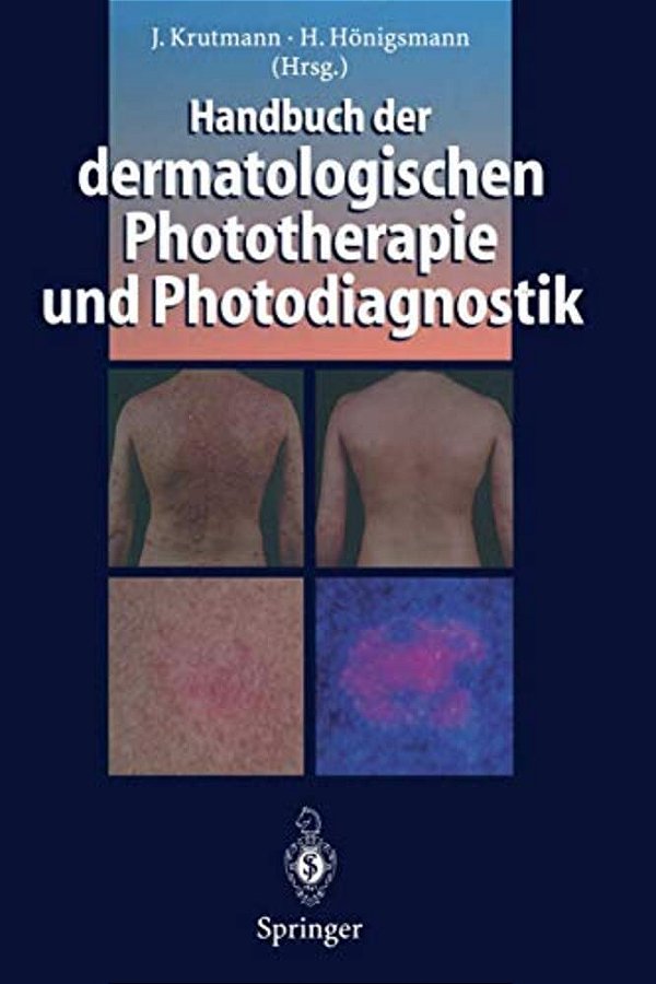 Handbuch Der Dermatologischen Phototherapie Und Photodiagnostik-..