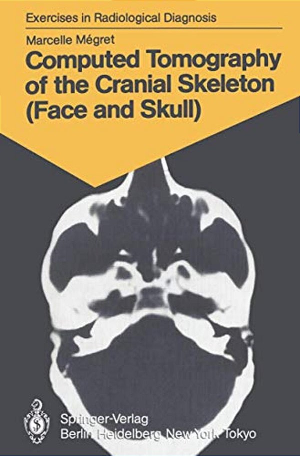 Computed Tomography Of The Cranial Skeleton (Face And Skull): 58 Radiological Exercises For Students And Practitioners-..