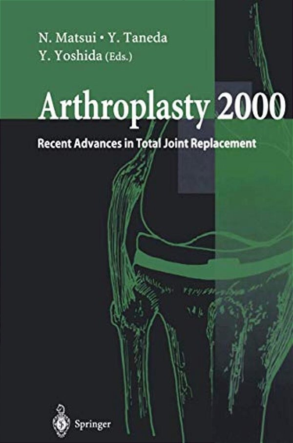 Arthroplasty 2000: Recent Advances In Total Joint Replacement-..