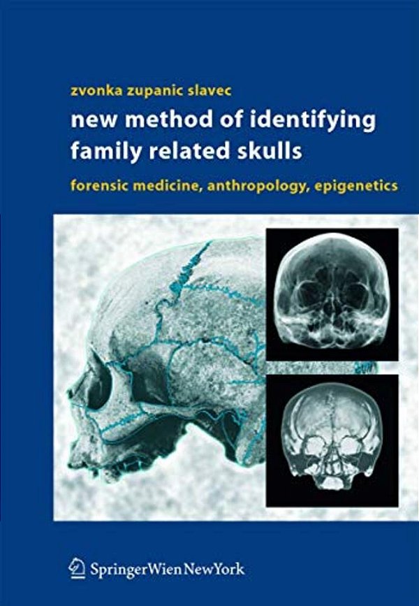 New Method Of Identifying Family Related Skulls: Forensic Medicine, Anthropology, Epigenetics-..