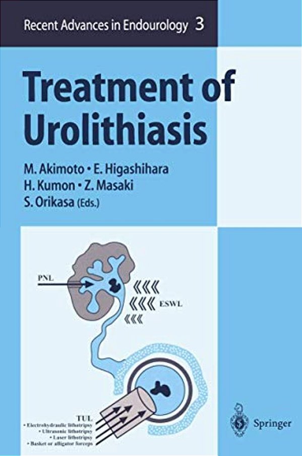 Treatment Of Urolithiasis-..