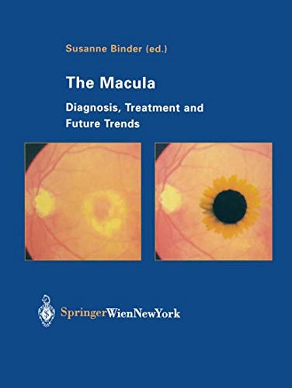 The Macula: Diagnosis, Treatment And Future Trends-..