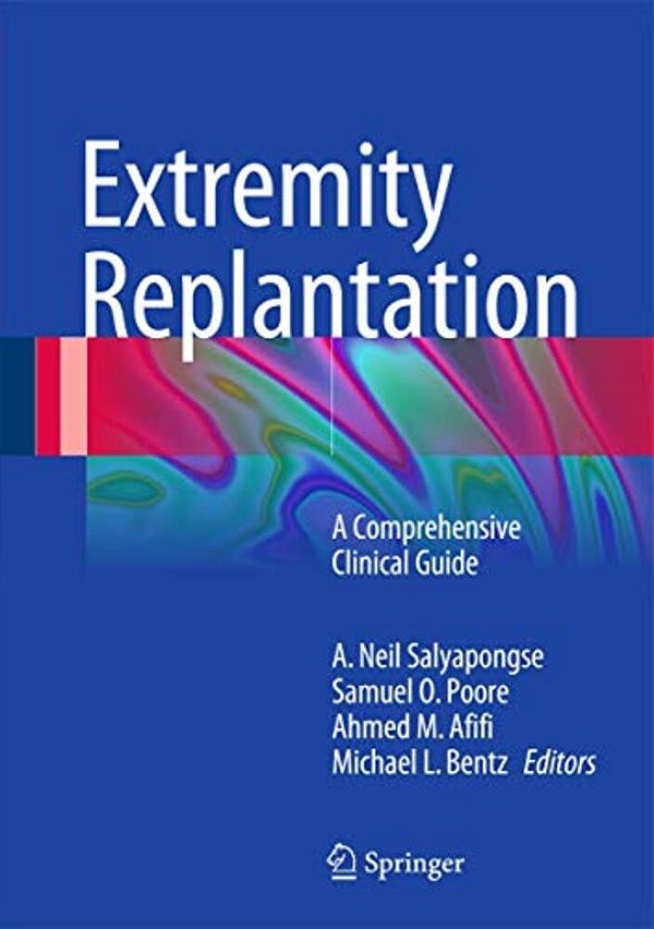 Extremity Replantation: A Comprehensive Clinical Guide-..