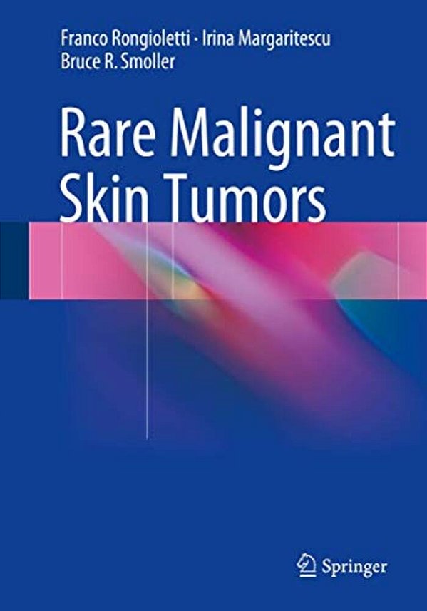 Rare Malignant Skin Tumors-..