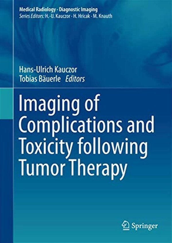 Imaging Of Complications And Toxicity Following Tumor Therapy-..