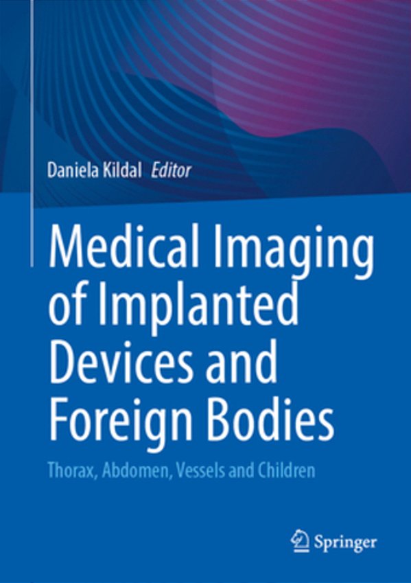 Medical Imaging Of Implanted Devices And Foreign Bodies: Thorax, Abdomen, Vessels And Children-..