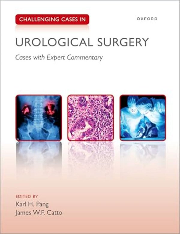 Challenging Cases In Urological Surgery-..