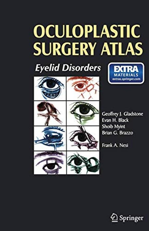 Oculoplastic Surgery Atlas: Eyelid Disorders-..