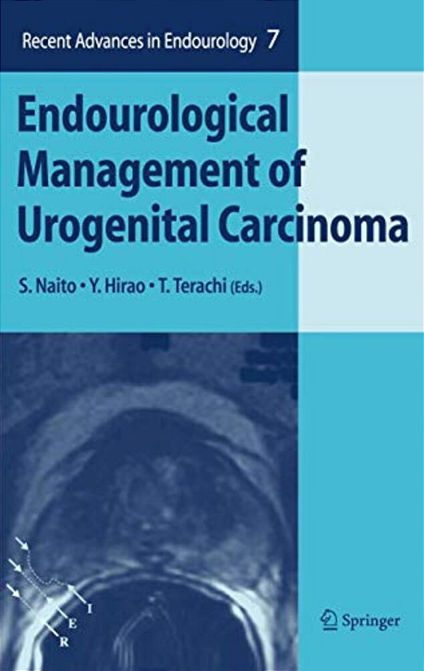 Endourological Management Of Urogenital Carcinoma-..