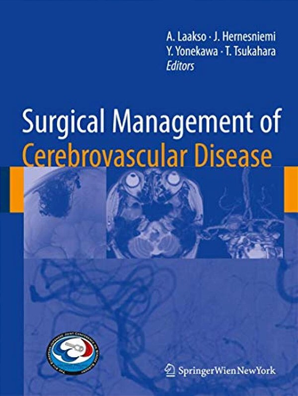 Surgical Management Of Cerebrovascular Disease-..
