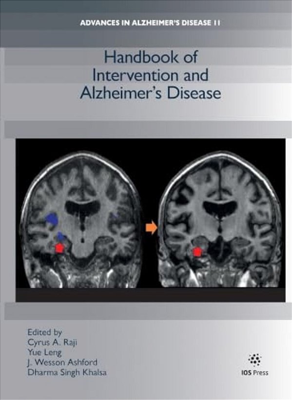 Handbook Of Intervention And Alzheimer's Disease-..