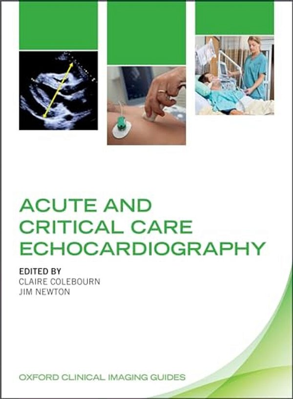 Acute And Critical Care Echocardiography-..