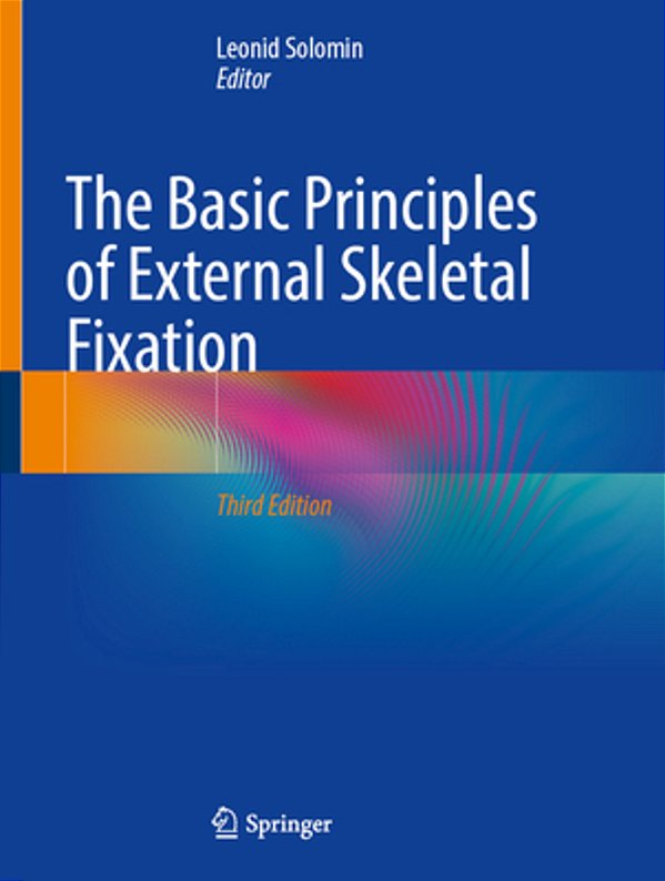 The Basic Principles Of External Skeletal Fixation-..