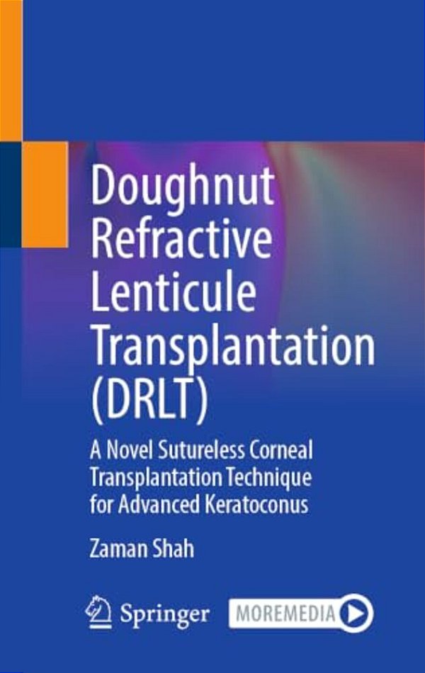 Doughnut Refractive Lenticule Transplantation (Drlt): A Novel Sutureless Corneal Transplantation Technique For Advanced Keratoconus-..