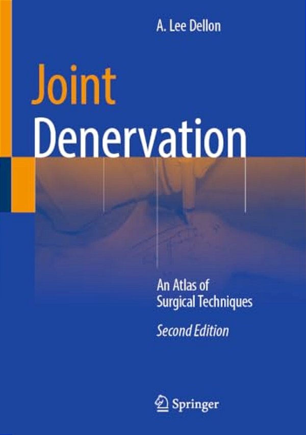 Joint Denervation: An Atlas Of Surgical Techniques-..