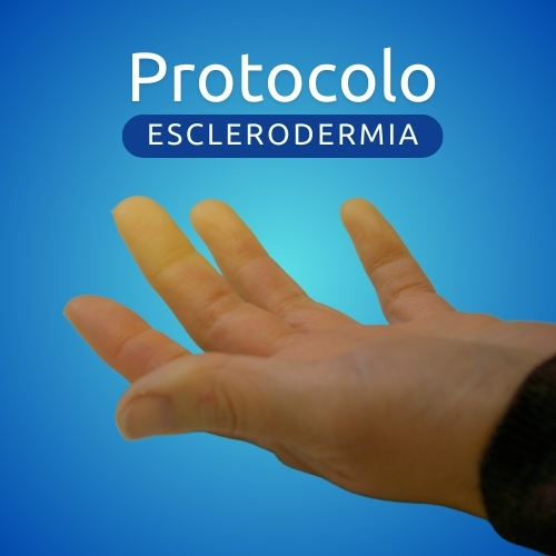 Esclerodermia