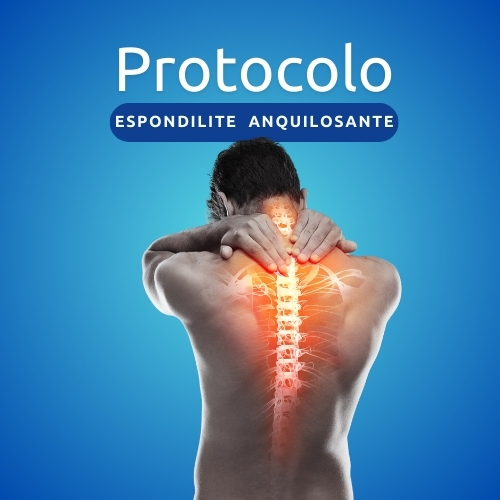 Espondilite Anquilosante