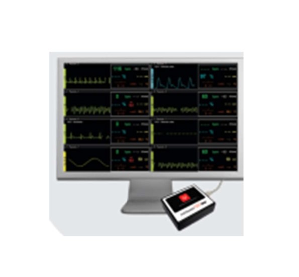 Central de Monitorização