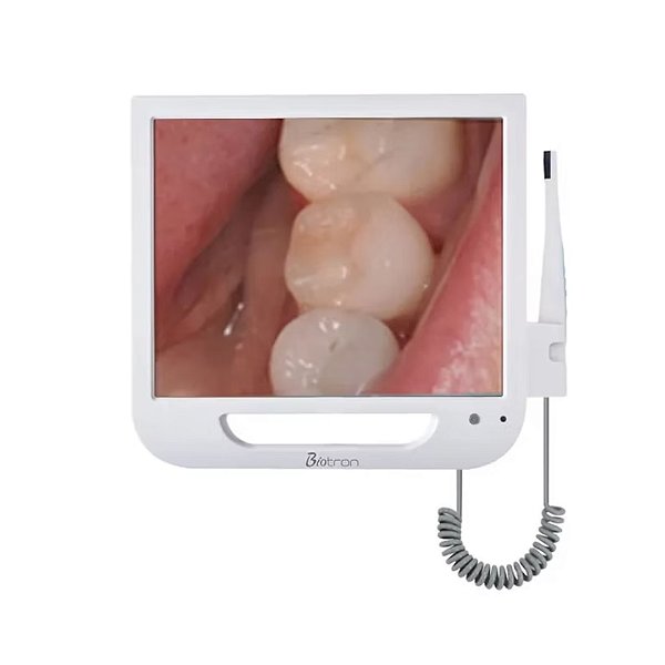 Câmera Intraoral com Monitor de 17 polegadas - Biotron