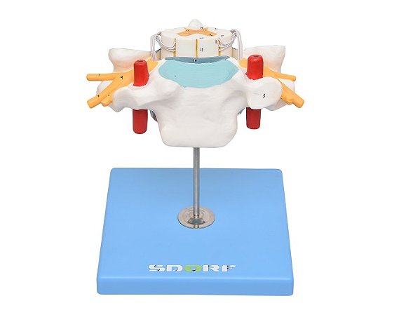 VÉRTEBRA CERVICAL COM CORDÃO ESPINHAL