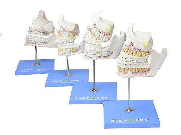 DESENVOLIMENTO DA DENTIÇÃO EM 4 ETAPAS
