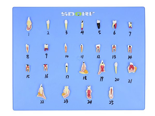 MODELO DE PATOLOGIA DENTÁRIAS C/ 25 PARTES EM PLACA