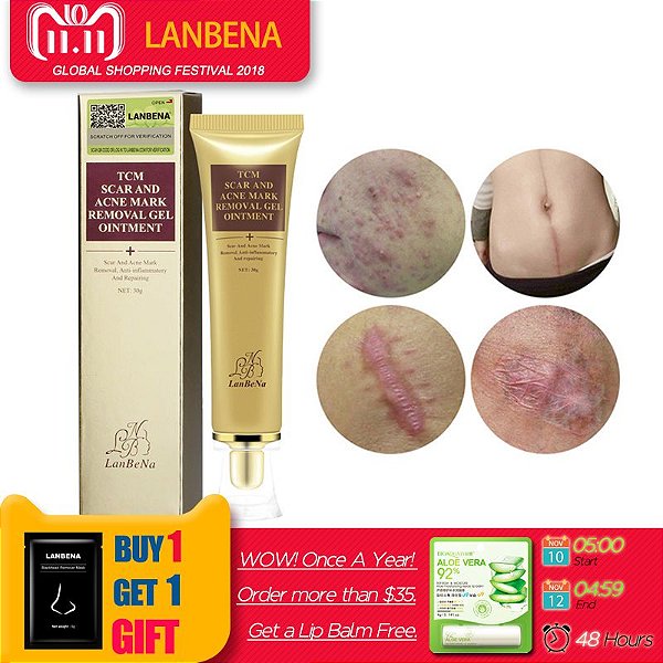 LANBENA Creme Da Remoção Da Cicatriz Extrato do Ginseng