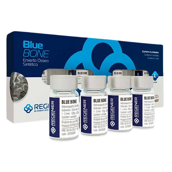 :: Enxerto Ósseo Sintético BLUE BONE (Grânulos | 4x 0,25g | 1,0g) - REGENER