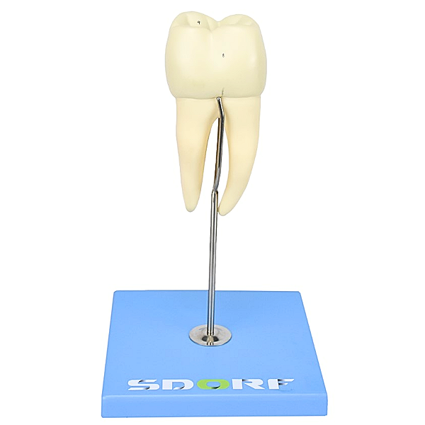 DENTE MOLAR INFERIOR C/ RAIZ DUPLA EM 3 PARTES C/ CÁRIE