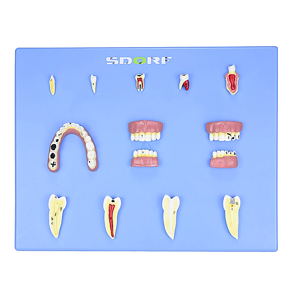 MODELO DE PATOLOGIAS DENTÁRIAS C/ 12 PARTES EM PLACA
