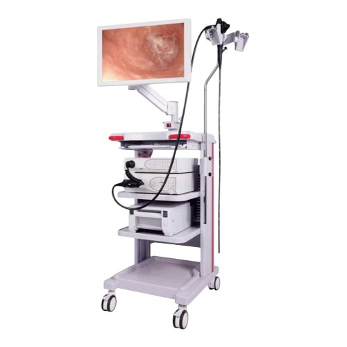 Conjunto para video endoscopia completo