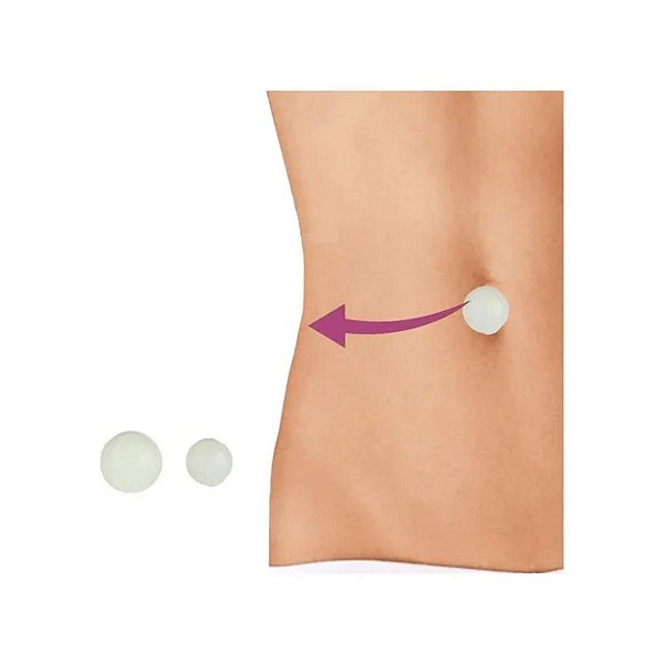 Órtese Siligel Macia Umbigo Esférica 9mm e 12mm Ortho Pauher