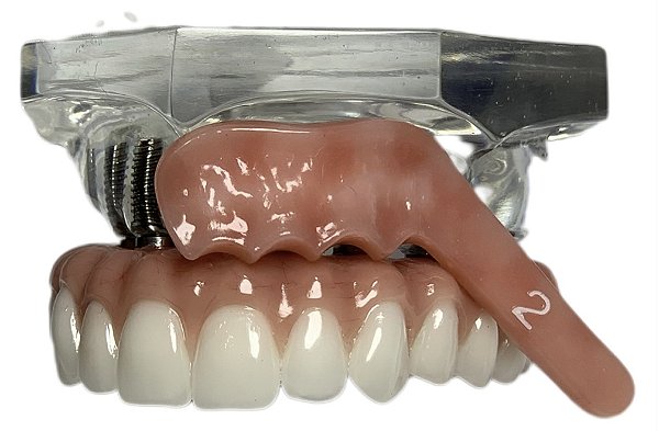 Manequim Odontológico Protocolo Superior 6 Implantes