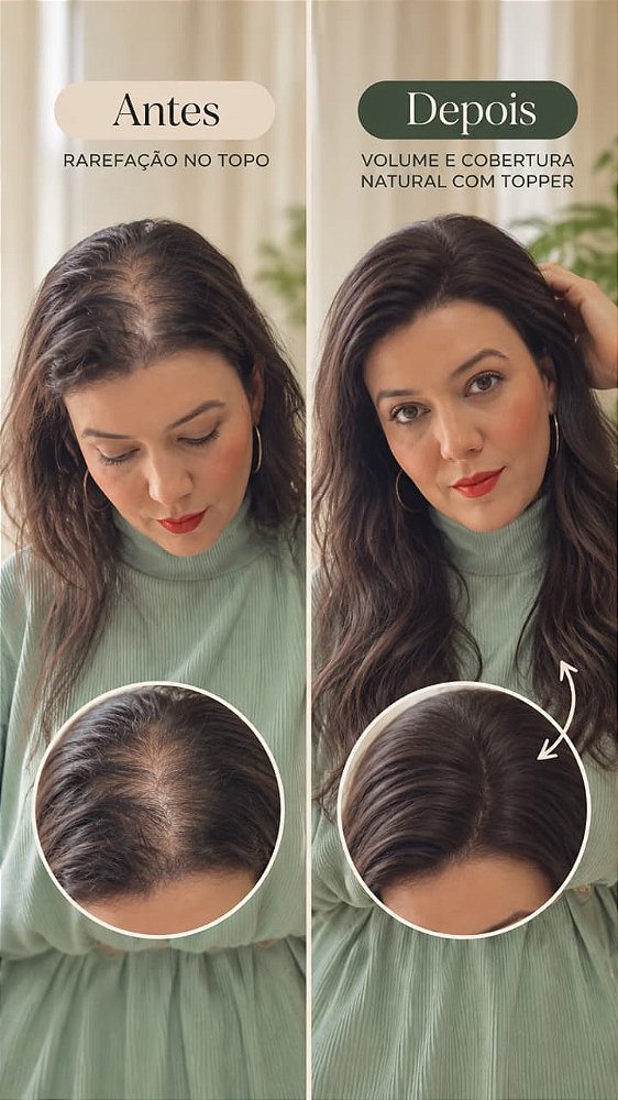 Topo capilar Feminino Cabelo Humano 35cm Repartição livre