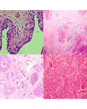 Conjunto de lâminas preparadas para Patologia - 30 peças