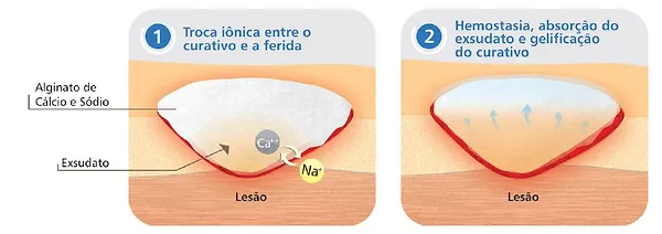 Curatec Alginato de Cálcio e Sódio