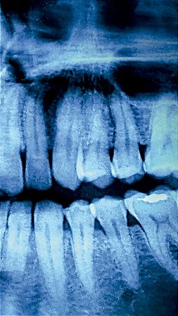 Lado B I Le Pracian (Poesia)