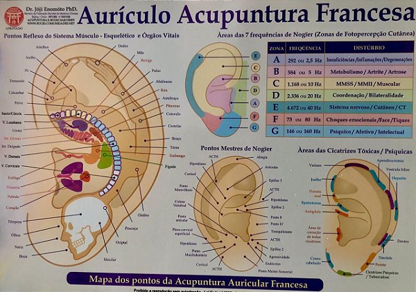 Mapa Auricular Francesa - Cinco Elementos Carpe Diem