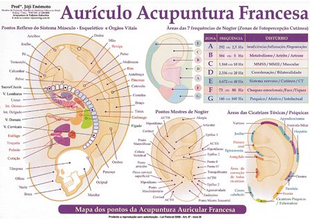 MAPA AURÍCULO ACUPUNTURA FRANCESA