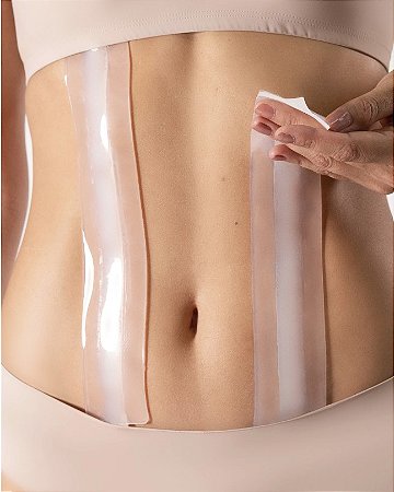 Fita Para Lipo Shape HD Triangular Autocolante 2 Unidades De 40cm Tam U - Siliskin